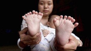 31 ujjal született a kínai kisbaba!