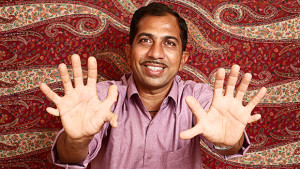 A 28 ujjú indiai asztalos Guinness rekorder lett!